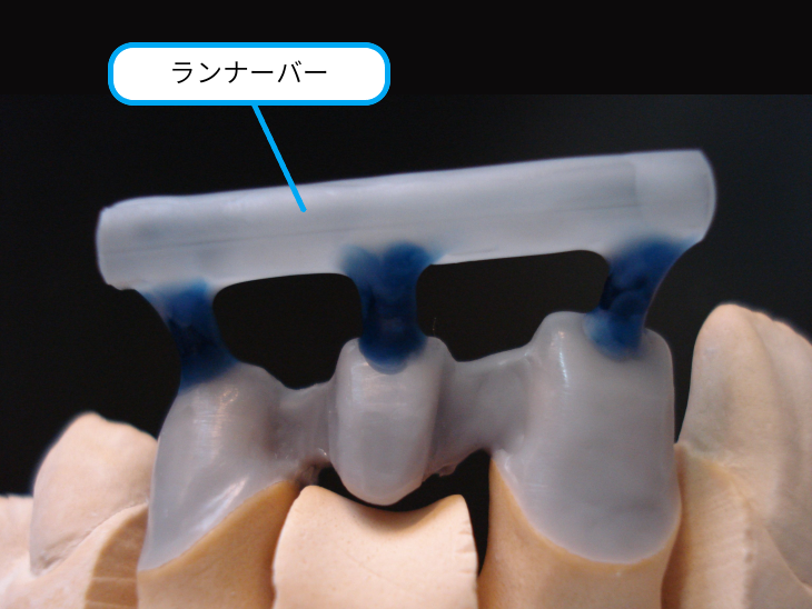 歯科技工 ザ.メタルセラミックス 山本 眞 著 クインテッセンス発行 - 本