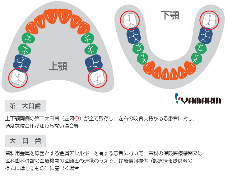 2020年9月のCAD/CAM冠 適応範囲拡大について | Y-News