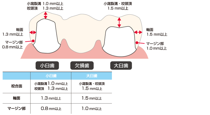 アナトミカル白齒咬合形成法　歯科　歯科技工　レア シンボーQ&A】使用方法について① | Y-News
