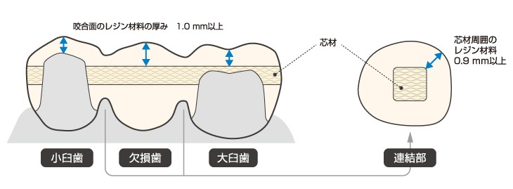 シンボーQ&A】使用方法について① | Y-News